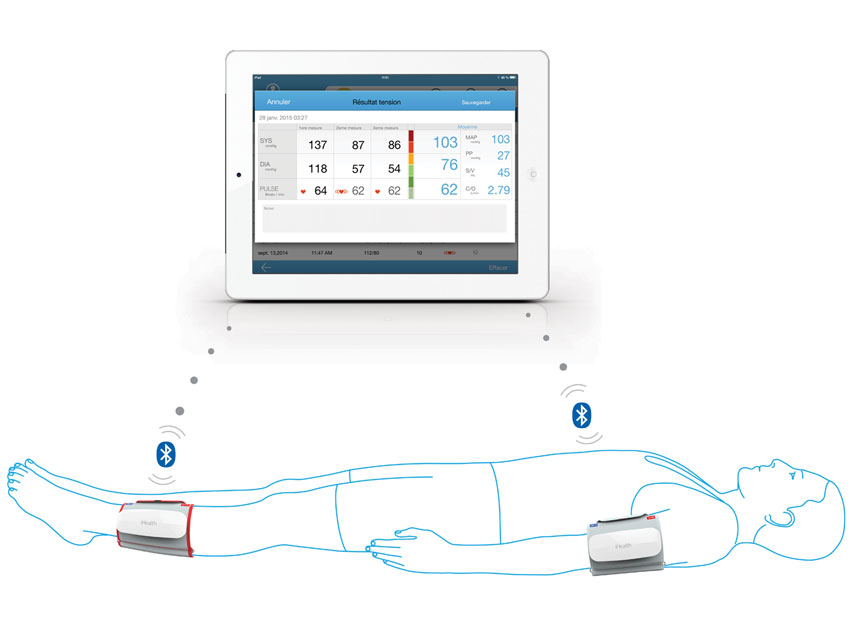 iHEALTH WIRELESS CARDIO LAB