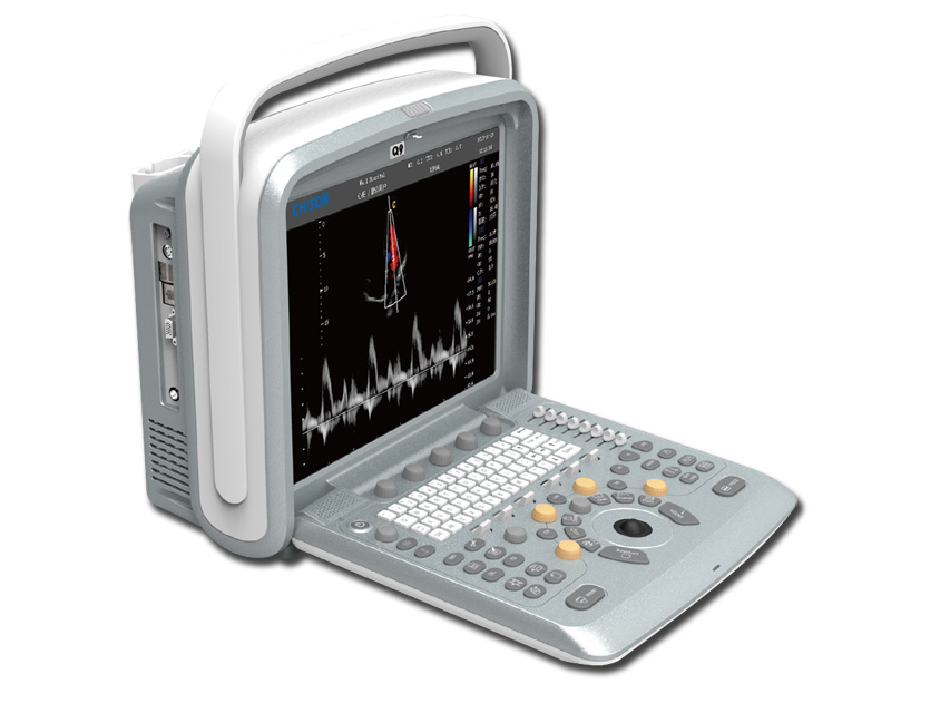 Chison Q9 COLOURDOPPLER PORTABIL