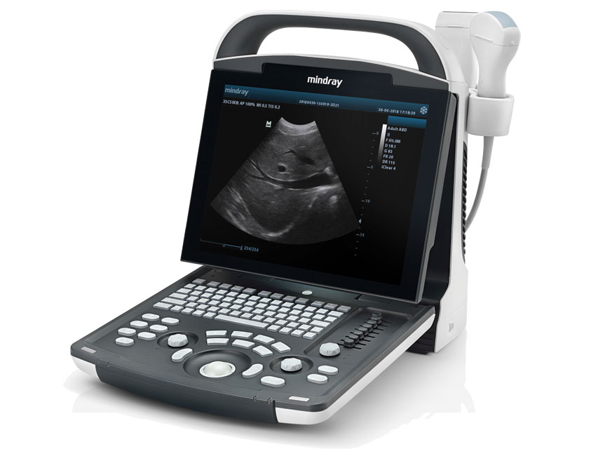 NOUL ECOGRAFIE MINDRAY DP-20