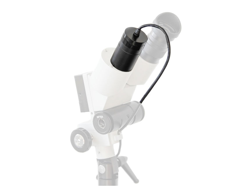 CAMERA DIGITALA COLPOSCOPE - USB