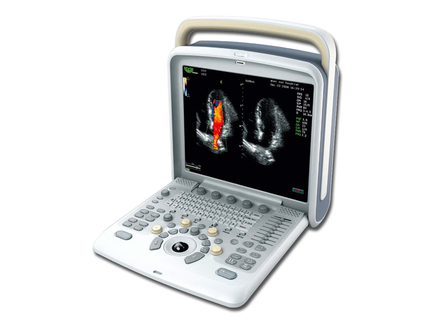 Chison Q5 COLOURDOPPLER PORTABIL