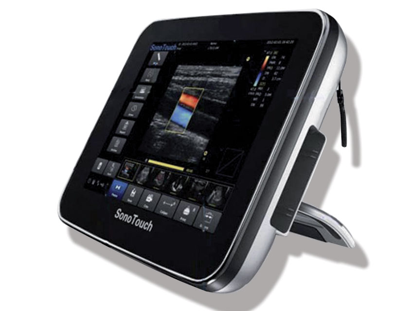 SONOTOUCH 30 Ecografie - Culoare