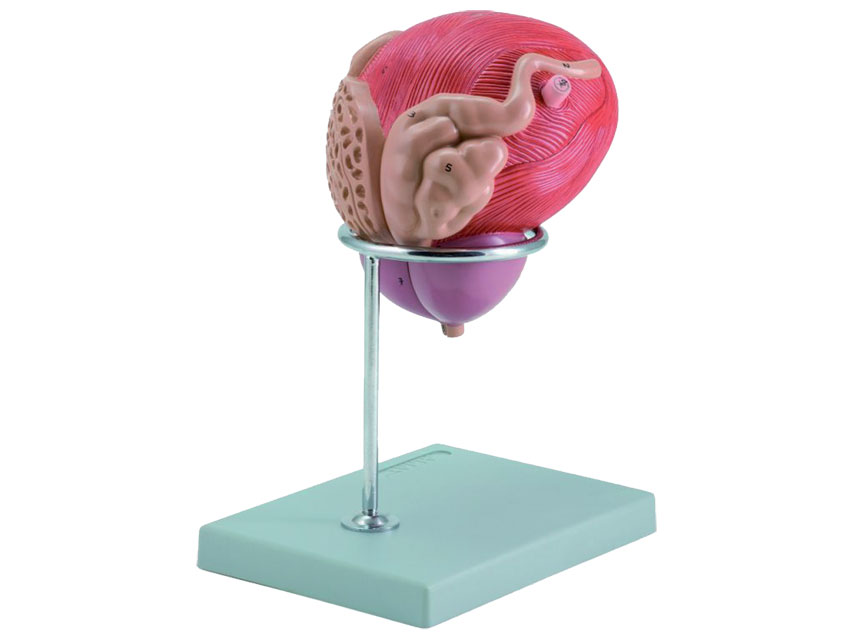 VEZICA URINARĂ MASCULINĂ CU PROSTATĂ