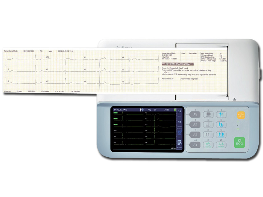 ELECTROCARDIOGRAF MINDRAY BENEHEART R3