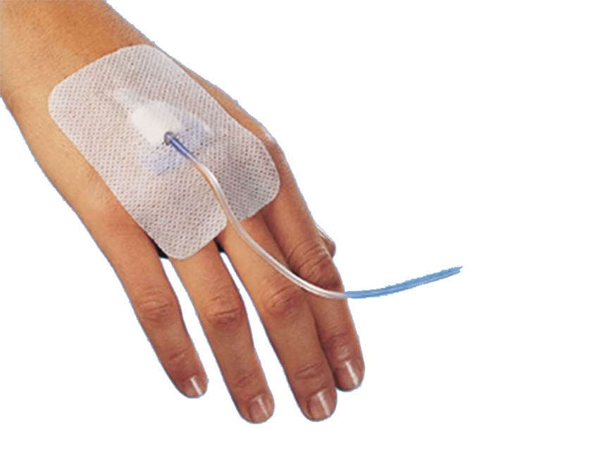 DISPOZIT Adeziv STERIL PENTRU FIXARE CANNULA