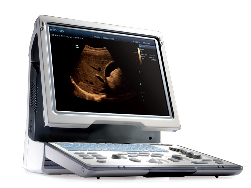 Mindray DP-50 ULTRASOUND